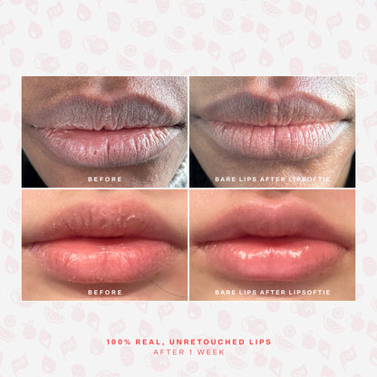 [Shared: Before and after photos of 2 different lips showing the hydrating effects of Tower 28 Beauty LipSoftie® Lip Treatment]