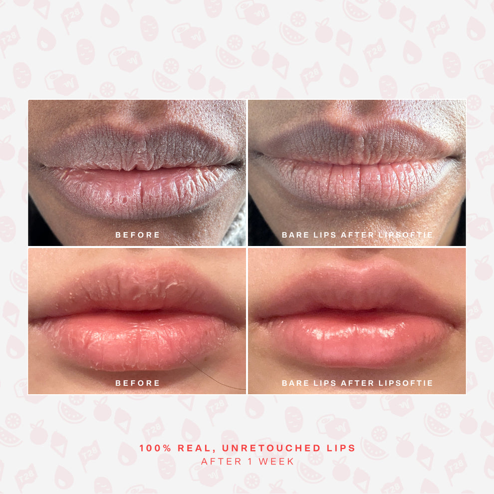 [Shared: Before and after photos of 2 different lips showing the hydrating effects of Tower 28 Beauty LipSoftie® Lip Treatment