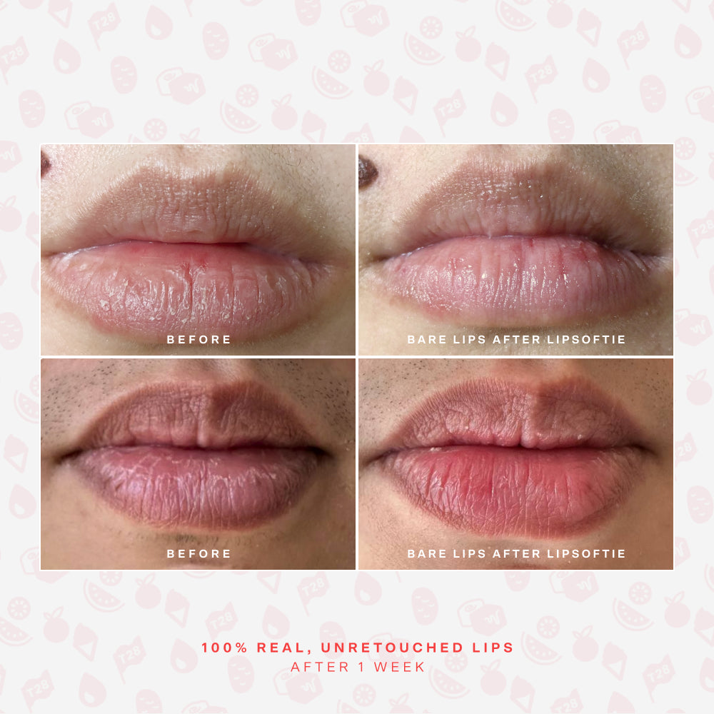 [Shared: Before and after photos of 2 different lips showing the hydrating effects of Tower 28 Beauty LipSoftie® Lip Treatment]