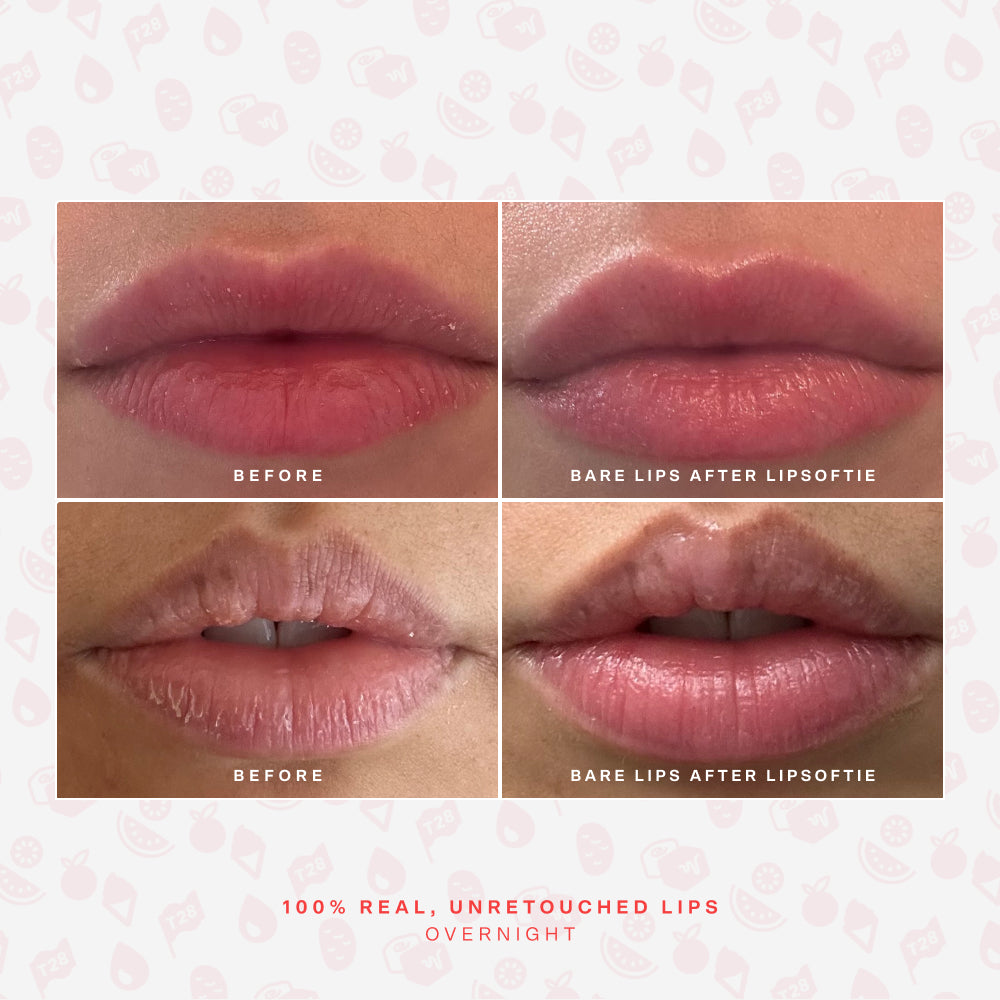 [Shared: Before and after photos of 2 different lips showing the hydrating effects of Tower 28 Beauty LipSoftie®Lip Treatment]