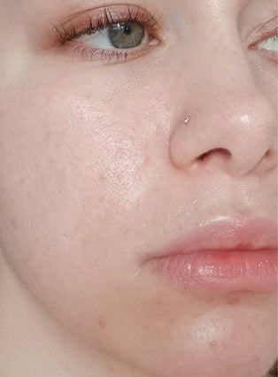 SOS Serum - 1.5 OZ / 60 ML[SOS Serum-1.5 OZ / 60 ML-39722654695479-Before + After]